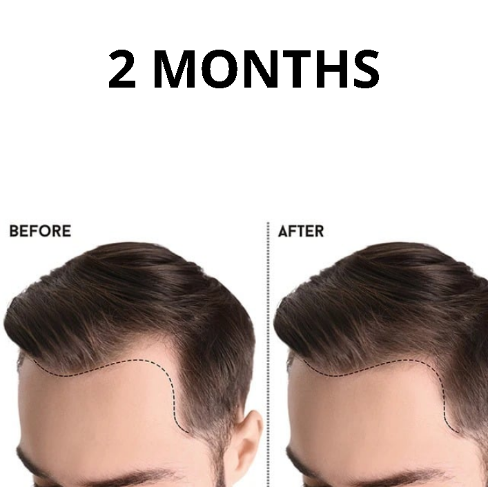 Rosemary Hair Revival Serum™