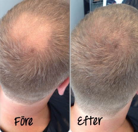 Alvaro - Hårförtätande Serum (25ml - 45-60 dagar)