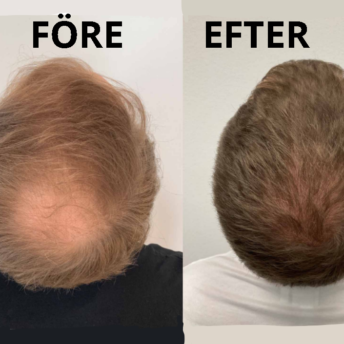 Alvaro - Hårförtätande Serum (25ml - 45-60 dagar)